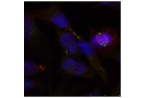 Image no. 2 for anti-ELK1, Member of ETS Oncogene Family (ELK1) (Ser389) antibody (ABIN197161) (ELK1 antibody  (Ser389))