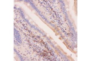 Immunohistochemistry (IHC) image for anti-ATP-Binding Cassette, Sub-Family C (CFTR/MRP), Member 4 (ABCC4) (AA 1-370) antibody (ABIN3043774)