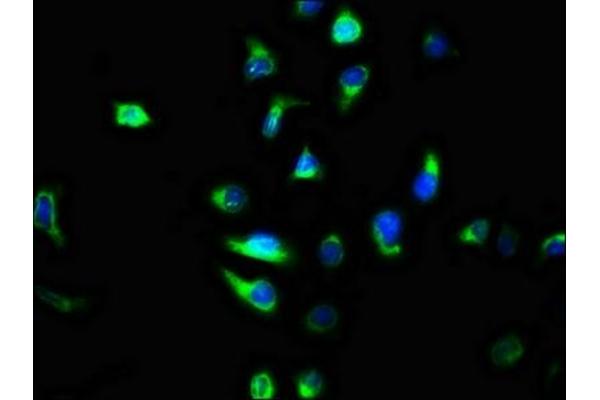 TMEM2 antibody  (AA 734-866)