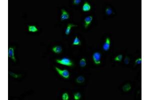 Immunofluorescence staining of A549 cells with ABIN7147330 at 1:100, counter-stained with DAPI. (TMEM2 antibody  (AA 734-866))