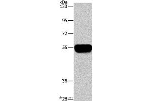 Western blot analysis of Human plasma tissue, using AHSG Polyclonal Antibody at dilution of 1:1450 (Fetuin A antibody)