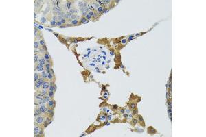 Immunohistochemistry of paraffin-embedded mouse testis using PLA2G2D antibody (ABIN5974036) at dilution of 1/100 (40x lens). (PLA2G2D antibody)