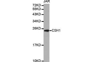 Western blot analysis of extracts of JAR cell line, using CSH1 antibody. (CSH1 antibody  (AA 27-217))