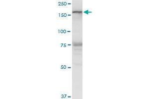 LMTK3 polyclonal antibody (A01), Lot # 060525JCS1. (LMTK3 antibody  (AA 1151-1250))