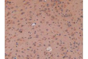 IHC-P analysis of Mouse Brain Tissue, with DAB staining. (APC antibody  (AA 2636-2845))