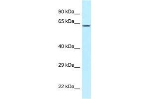 WB Suggested Anti-CCT3 Antibody Titration: 1. (CCT3 antibody  (C-Term))