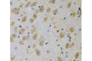 Immunohistochemistry of paraffin-embedded Rat brain using IGFBP4 Polyclonal Antibody at dilution of 1:100 (40x lens). (IGFBP4 antibody)