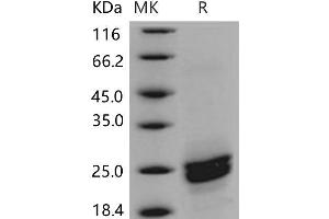 Western Blotting (WB) image for Phospholipase A2, Group XIIB (PLA2G12B) protein (His tag) (ABIN7320191) (PLA2G12B Protein (His tag))