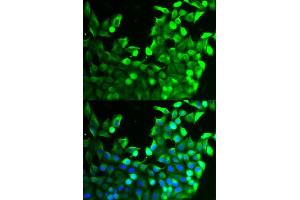 Immunofluorescence analysis of MCF-7 cells using FGFR2 antibody (ABIN5971103). (FGFR2 antibody)