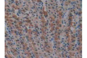 IHC-P analysis of Rat Stomach Tissue, with DAB staining. (TXNRD1 antibody  (AA 208-433))