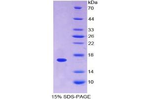 SDS-PAGE analysis of Human Annexin A3 Protein. (Annexin A3 Protein (ANXA3))