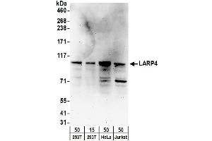 anti-La Ribonucleoprotein Domain Family, Member 4 (LARP4) (AA 450-500) antibody