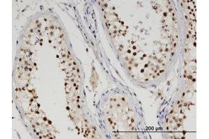 Image no. 1 for anti-tyrosyl-DNA phosphodiesterase 2 (TDP2) (AA 1-363) antibody (ABIN599560) (TDP2 antibody  (AA 1-363))