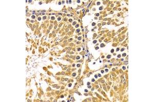 Immunohistochemistry of paraffin-embedded rat testis using PIBF1 Antibody. (PIBF1 antibody)