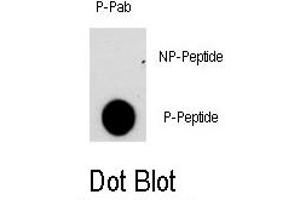 Image no. 1 for anti-Nuclear Factor of Activated T-Cells, Cytoplasmic, Calcineurin-Dependent 2 (NFAT1) (pSer330) antibody (ABIN358367)