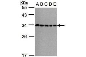 WB Image Sample(30μg whole cell lysate) A: 293T B: A431 , C: H1299 D: HeLa S3 , E: Hep G2 , 12% SDS PAGE antibody diluted at 1:1000 (CHMP5 antibody)