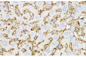 Immunohistochemistry of paraffin-embedded Mouse liver using YKL-40 / CHI3L1 Polyclonal Antibody at dilution of 1:100 (40x lens). (CHI3L1 antibody)