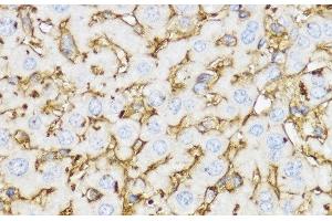 Immunohistochemistry of paraffin-embedded Mouse liver using YKL-40 / CHI3L1 Polyclonal Antibody at dilution of 1:100 (40x lens).