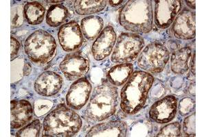 Image no. 2 for anti-3-Oxoacyl-ACP Synthase, Mitochondrial (OXSM) (AA 78-343) antibody (ABIN1491676) (OXSM antibody  (AA 78-343))
