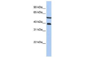 PHACTR3 antibody used at 1 ug/ml to detect target protein. (PHACTR3 antibody  (C-Term))