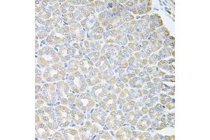 Immunohistochemistry of paraffin-embedded mouse stomach using SKAP2 antibody.