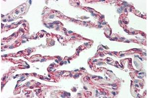 Image no. 2 for anti-TNFRSF1A-Associated Via Death Domain (TRADD) (AA 251-300) antibody (ABIN2879132) (TRADD antibody  (AA 251-300))