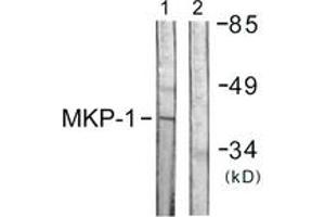Western blot analysis of extracts from Jurkat cells, using MKP1 (Ab-359) Antibody. (DUSP1 antibody  (AA 318-367))