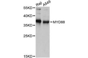 Western blot analysis of extracts of various cell lines, using MYD88 antibody. (MYD88 antibody)