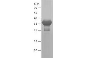 Western Blotting (WB) image for Ras Homolog Gene Family, Member T2 (RHOT2) (AA 392-541) protein (His-IF2DI Tag) (ABIN7124789) (RHOT2 Protein (AA 392-541) (His-IF2DI Tag))