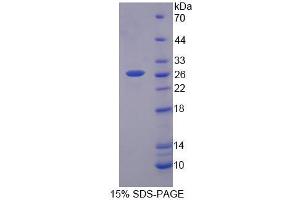 SDS-PAGE (SDS) image for Growth Factor Receptor-Bound Protein 10 (GRB10) (AA 392-594) protein (His tag) (ABIN6237108) (GRB10 Protein (AA 392-594) (His tag))