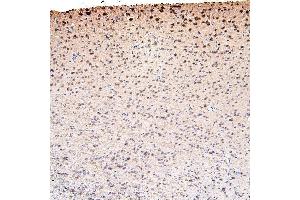 IHC analysis of CDK5 using anti-CDK5 antibody (ABIN6719393).