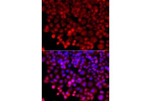 Immunofluorescence analysis of A549 cell using HARS antibody. (HARS1/Jo-1 antibody)