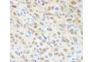 Immunohistochemistry (IHC) image for anti-Mitogen-Activated Protein Kinase Associated Protein 1 (MAPKAP1) (C-Term) antibody (ABIN7448795)