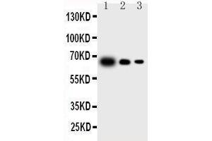 Western Blotting (WB) image for anti-Interleukin 23, alpha subunit p19 (IL23A) (AA 29-48), (N-Term) antibody (ABIN3043197)