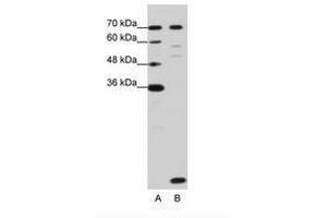Image no. 3 for anti-LSM2 Homolog, U6 Small Nuclear RNA Associated (LSM2) (C-Term) antibody (ABIN202014) (LSM2 antibody  (C-Term))