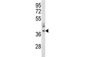CRACM1 antibody western blot analysis in A375 lysate. (ORAI1 antibody  (AA 269-298))