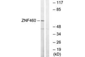 Western blot analysis of extracts from LOVO cells, using ZNF460 Antibody. (ZNF460 antibody  (AA 461-510))