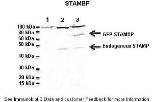 Lanes:  1: 20ug Jukart cell lysate, 2: 20ug untransfected Hela lysate, 3: 20ug GFP-STAMBP transfected HeLa lysate Primary Antibody Dilution:  1:1000 Secondary Antibody:  Goat anti-rabbit-HRP Secondary Antibody Dilution:  1:2000 Gene Name:  CDC26 Submitted by:  Dr. (CDC26 antibody  (Middle Region))