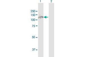 Western Blot analysis of MTHFD1 expression in transfected 293T cell line by MTHFD1 MaxPab polyclonal antibody.