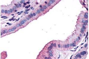 Immunohistochemical staining of human gallbladder, epithelium with CCKAR polyclonal antibody . (CCKAR antibody  (N-Term))