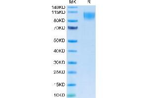 Human CD30 on Tris-Bis PAGE under reduced condition. (TNFRSF8 Protein (AA 19-379) (Fc Tag))