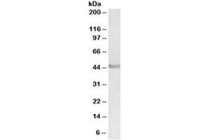 Western blot testing of human duodenum lysate with PAX3 antibody at 0. (Paired Box 3 antibody)