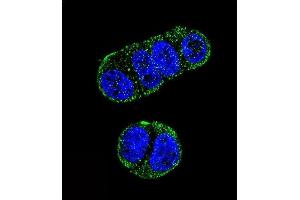 Confocal immunofluorescent analysis of FOLH1 Antibody (N-term) (ABIN657630 and ABIN2846626) with ZR-75-1 cell followed by Alexa Fluor 488-conjugated goat anti-rabbit lgG (green). (PSMA antibody  (N-Term))