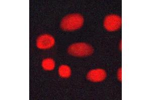 ABIN6269045 staining MCF-7 cells by ICC/IF. (CHEK1 antibody  (Internal Region))