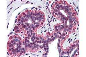Anti-p73 antibody IHC of human breast.
