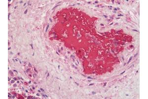 Human Spleen: Formalin-Fixed, Paraffin-Embedded (FFPE). (Hemoglobin Alpha 1 + 2 (HBA1,HBA2) antibody (HRP))