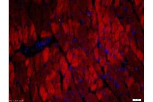 Paraformaldehyde-fixed, paraffin embedded rat heart, Antigen retrieval by boiling in sodium citrate buffer (pH6) for 15min, Block endogenous peroxidase by 3% hydrogen peroxide for 30 minutes, Blocking buffer (normal goat serum) at 37°C for 20min, Antibody incubation with Rabbit Anti-Troponin T Polyclonal Antibody, Unconjugated  at 1:500 overnight at 4°C, followed by a conjugated secondary Goat Anti-Rabbit IgG, Cy3 conjugated-Cy3)used at 1:200 dilution for 40 minutes at 37°C. (Troponin T antibody  (AA 201-298))