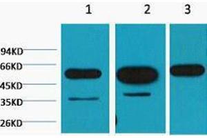 Western Blotting (WB) image for anti-Tubulin, beta (TUBB) antibody (ABIN3178688) (TUBB antibody)