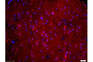 Formalin-fixed and paraffin embedded mouse brain labeled with Anti-phospho-Tau protein(Ser396) Polyclonal Antibody, Unconjugated (ABIN746453) at 1:200 followed by conjugation to the secondary antibody Goat Anti-Rabbit IgG, Cy3 conjugated used at 1:200 dilution for 40 minutes at 37°C and DAPI staining