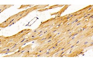 Detection of SPR in Mouse Cardiac Muscle Tissue using Polyclonal Antibody to Sepiapterin Reductase (SPR) (SPR antibody  (AA 1-261))